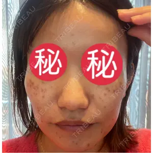 東京シルククリニック 東京シルククリニック 新宿院口コミ