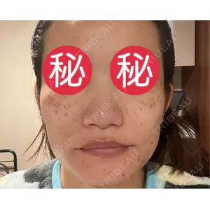 東京シルククリニック 東京シルククリニック 新宿院口コミ