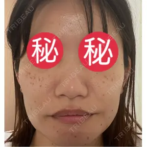 東京シルククリニック 東京シルククリニック 新宿院口コミ