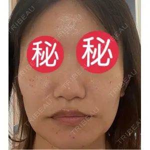 東京シルククリニック 東京シルククリニック 新宿院口コミ