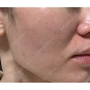 クレオビューティークリニック口コミ