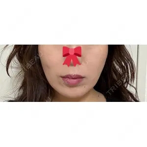 APスキンクリニック銀座の