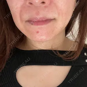 Fellez Clinic【フェルズクリニック】口コミ