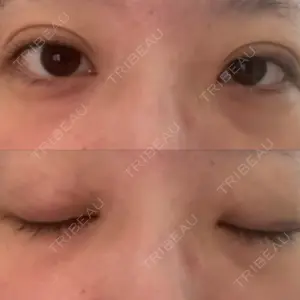 アリエル美容クリニック アリエル美容クリニック 横浜院口コミ