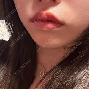 フィラークリニック フィラークリニック 大阪心斎橋院口コミ