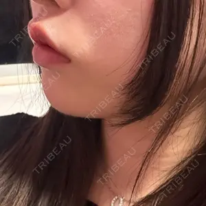 フィラークリニック フィラークリニック 大阪心斎橋院口コミ