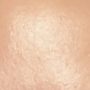 新宿駅三丁目クリニック口コミ