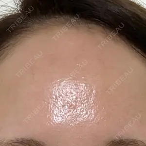 AI Beauty Clinic （エーアイ美容クリニック）口コミ