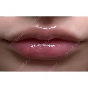 L‘amour clinic Tokyo【ラムールクリニック東京】口コミ