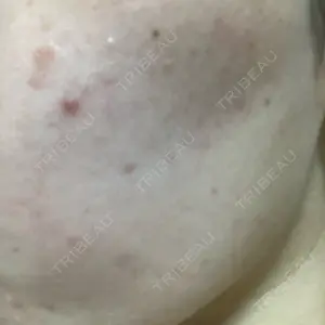 おおかみ美容のクリニック おおかみ美容のクリニック 横浜院口コミ