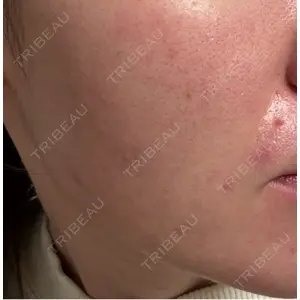 クレオビューティークリニック口コミ