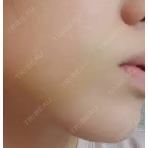 Chloe Cheongdam Clinic （クロエチョンダムクリニック）口コミ