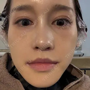 銀座マイアミ美容外科口コミ