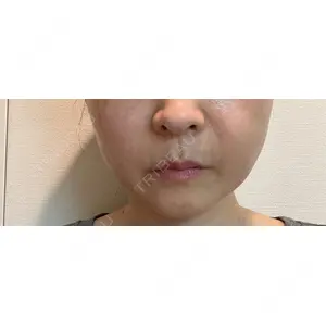 口コミ