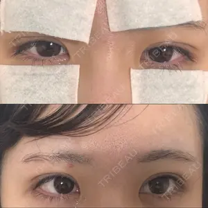 広島プルミエクリニック口コミ