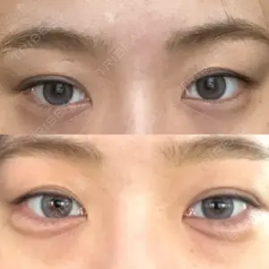 キアクリニック KIA CLINIC 心斎橋院口コミ