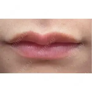 HAAB BEAUTY CLINIC 南青山本院（新院）口コミ