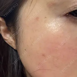 きれいクリニック口コミ