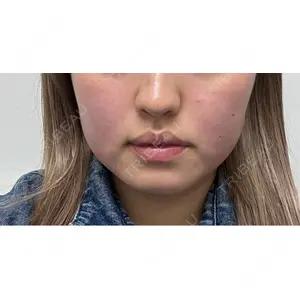 東京シルククリニック 東京シルククリニック 新宿院口コミ