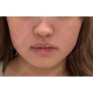 東京シルククリニック 東京シルククリニック 新宿院口コミ