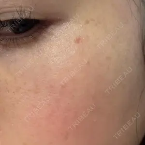 きれいクリニック口コミ