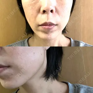 東京シンデレラ美容外科 東京シンデレラ美容外科 池袋院口コミ