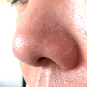 ゆきスキンクリニック 東池袋口コミ