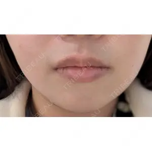 BiBiクリニック口コミ