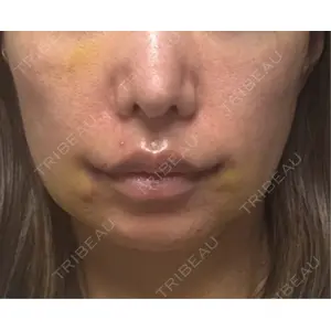 R Beauty CLINIC R Beauty CLINIC 銀座院口コミ