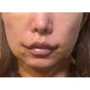 R Beauty CLINIC R Beauty CLINIC 銀座院口コミ