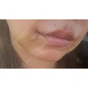 R Beauty CLINIC R Beauty CLINIC 銀座院口コミ