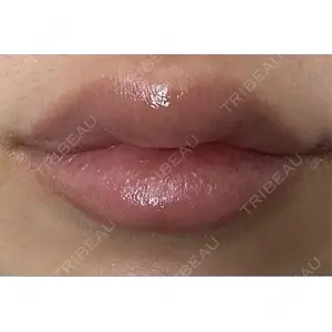 アリエル美容クリニック アリエル美容クリニック 横浜院口コミ