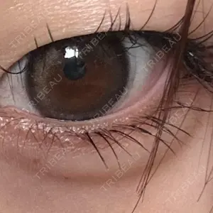 アリエル美容クリニック アリエル美容クリニック 横浜院口コミ