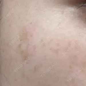 APスキンクリニック銀座口コミ