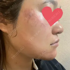 ルラ美容クリニック ルラ美容クリニック 仙台院 / ルラスキンクリニック 仙台院口コミ