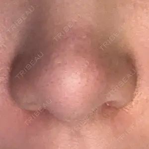 吉祥寺アイビークリニック口コミ