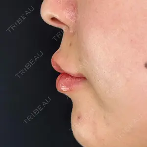 ルラ美容クリニック ルラ美容クリニック 大阪本院口コミ