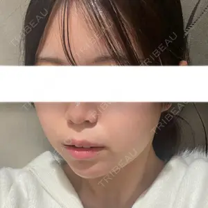 Nebula Clinic 新宿美容外科ネビュラクリニック口コミ