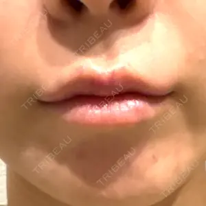 ルラ美容クリニック ルラ美容クリニック 大阪本院口コミ