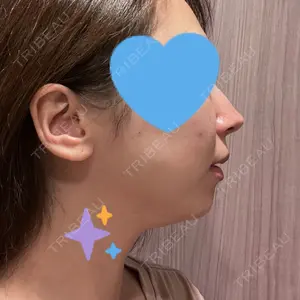 HINATA クリニック口コミ