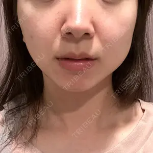 HINATA クリニック口コミ