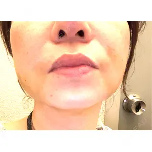 東京シンデレラ美容外科 東京シンデレラ美容外科 池袋院口コミ