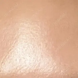 新宿駅三丁目クリニック口コミ