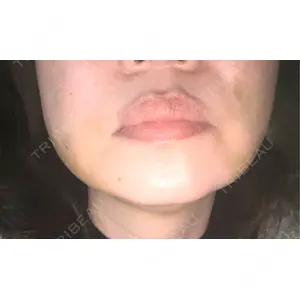 東京シンデレラ美容外科 東京シンデレラ美容外科 池袋院口コミ