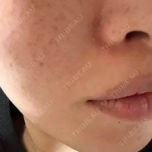 AZ BEAUTY CLINIC口コミ