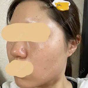 PureMe Skin Clinic（ピュアミースキンクリニック麻布）口コミ