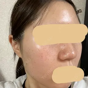 PureMe Skin Clinic（ピュアミースキンクリニック麻布）口コミ