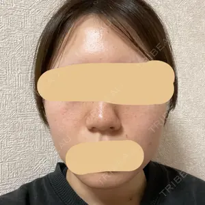 PureMe Skin Clinic（ピュアミースキンクリニック麻布）口コミ