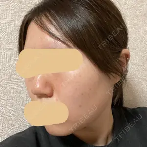 PureMe Skin Clinic（ピュアミースキンクリニック麻布）口コミ