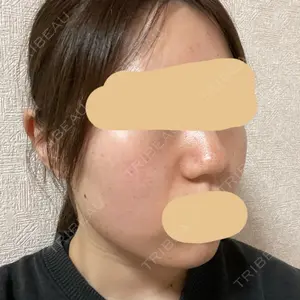 PureMe Skin Clinic（ピュアミースキンクリニック麻布）口コミ